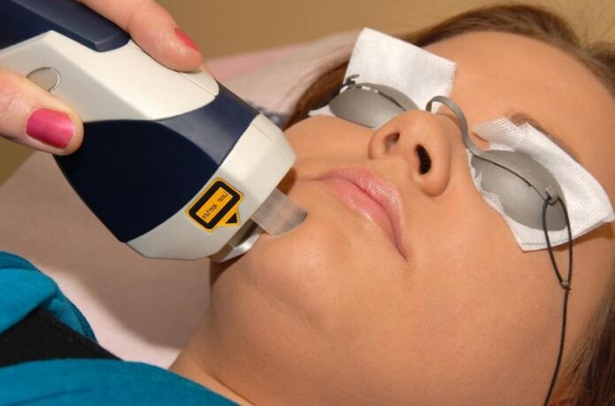 Efectul laser are un efect cumulativ