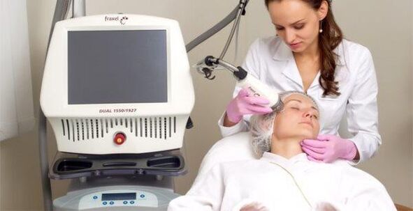 Întinerirea pielii cu laser fracționat