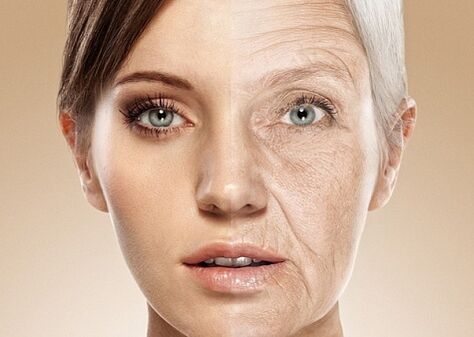 înainte și după întinerirea cu laser a feței pielii