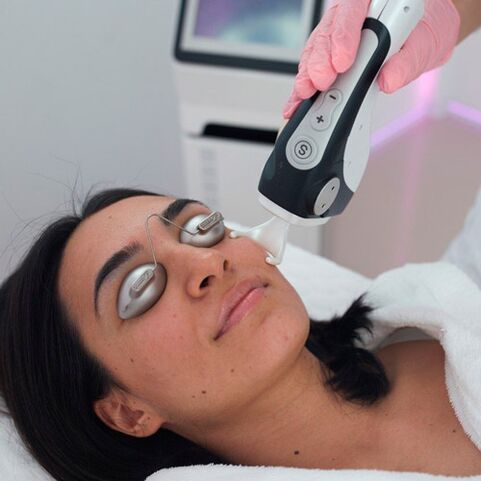 Tratamentul pielii faciale cu laser fracționat
